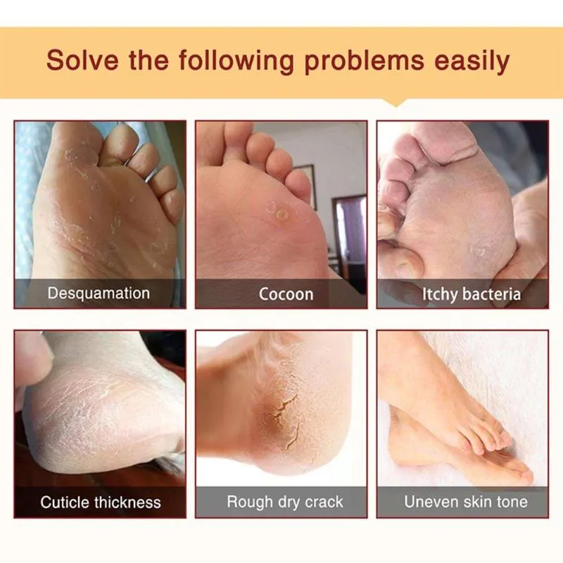 Foot Mask Exfoliating Renewal Pedicure Remove Dead Skin Heel Socks Peeling Foot Care